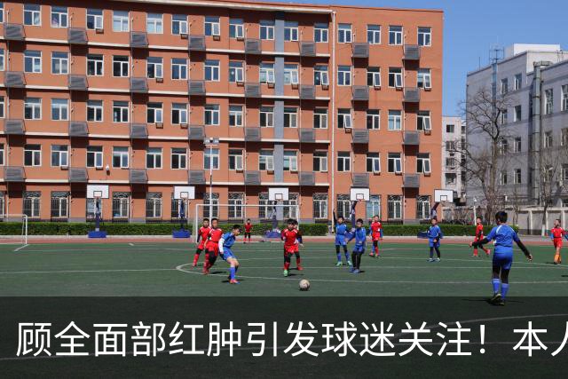 顾全面部红肿引发球迷关注！本人解释是多年皮肤问题并非外伤伤疤